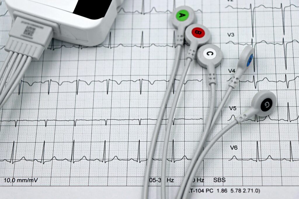 Multi-Label ECG Classification